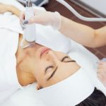 Microneedling with RF – Is It Worth It?